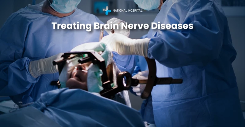 How to Treat Brain Nerve Diseases