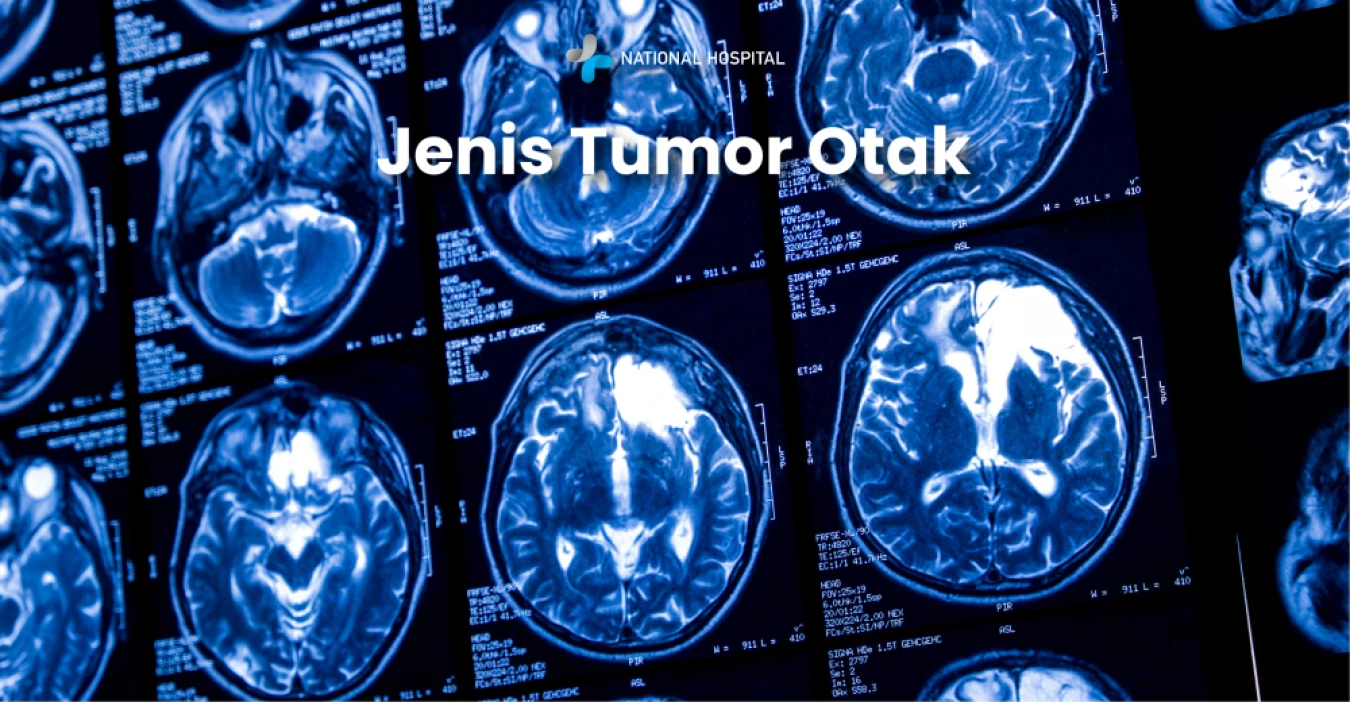 Jenis Tumor Otak