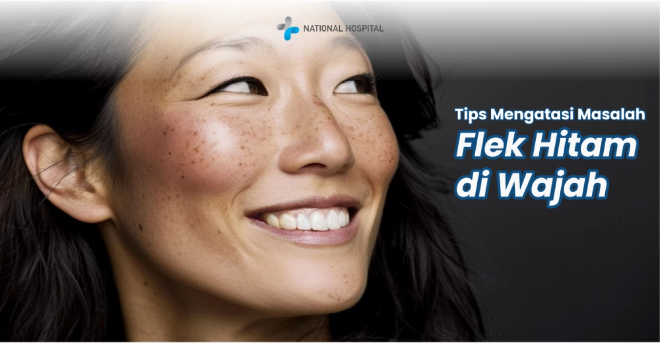 How to Remove Dark Spots on the Face with Laser
