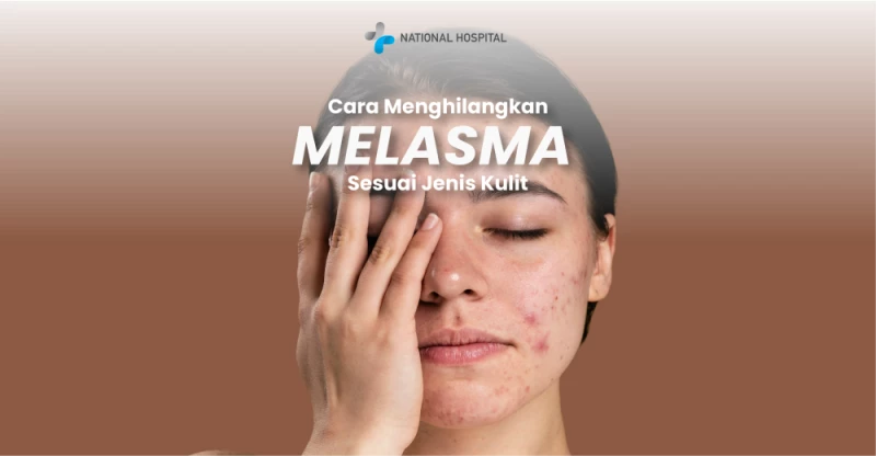 How to Treat Melasma According to Skin Type