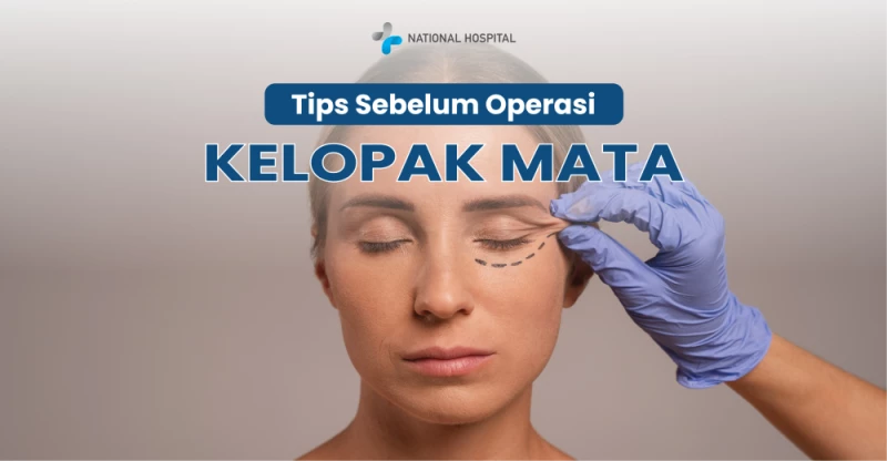 Tips Before Undergoing Double Eyelid Surgery