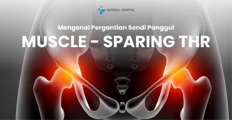 Muscle-Sparing Total Hip Replacement: A Breakthrough in Recovery and Comfort