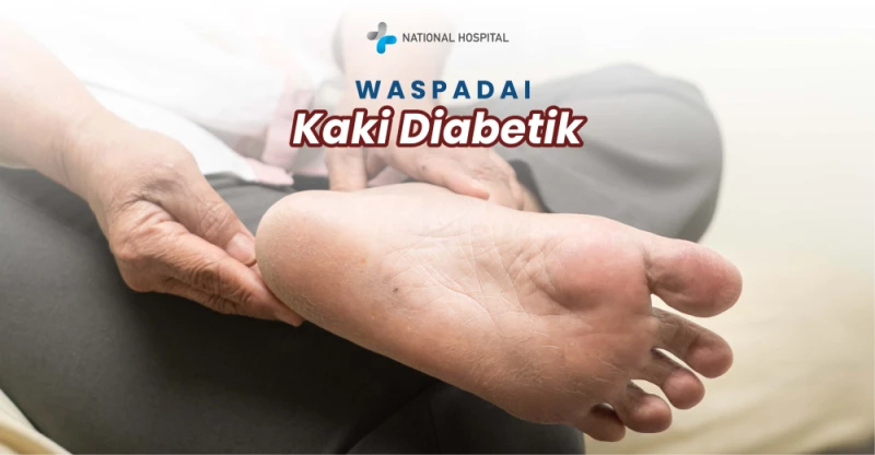 Mengenal Apa Itu Kaki Diabet, Ciri, dan Penanganannya
