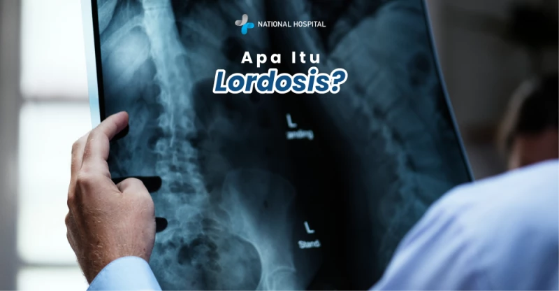 What Is Lordosis? Causes, Symptoms, and How to Treat It