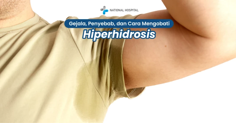 Hyperhidrosis Is: Symptoms, Causes, and How to Treat It