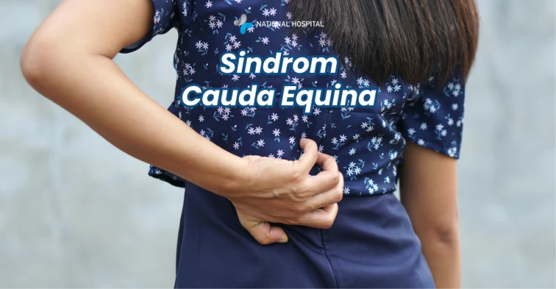 Cauda Equina Syndrome: Symptoms and Treatment