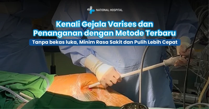 National Hospital Invites the Public to Recognize Varicose Vein Symptoms and the Latest Treatment Methods: No Scars, Minimal Pain, and Faster Recovery