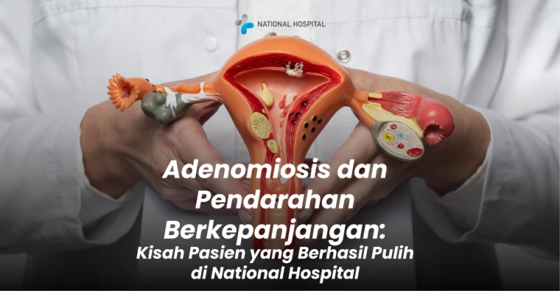 Adenomiosis dan Pendarahan Berkepanjangan: Kisah Pasien yang Berhasil Pulih di National Hospital