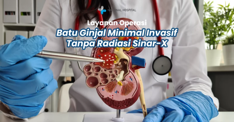 Layanan Operasi Batu Ginjal Minimal Invasif Tanpa Radiasi Sinar-X