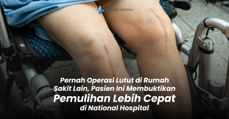 Pernah Operasi Lutut di Rumah Sakit Lain, Pasien Ini Membuktikan Pemulihan di National Hospital Lebih Cepat