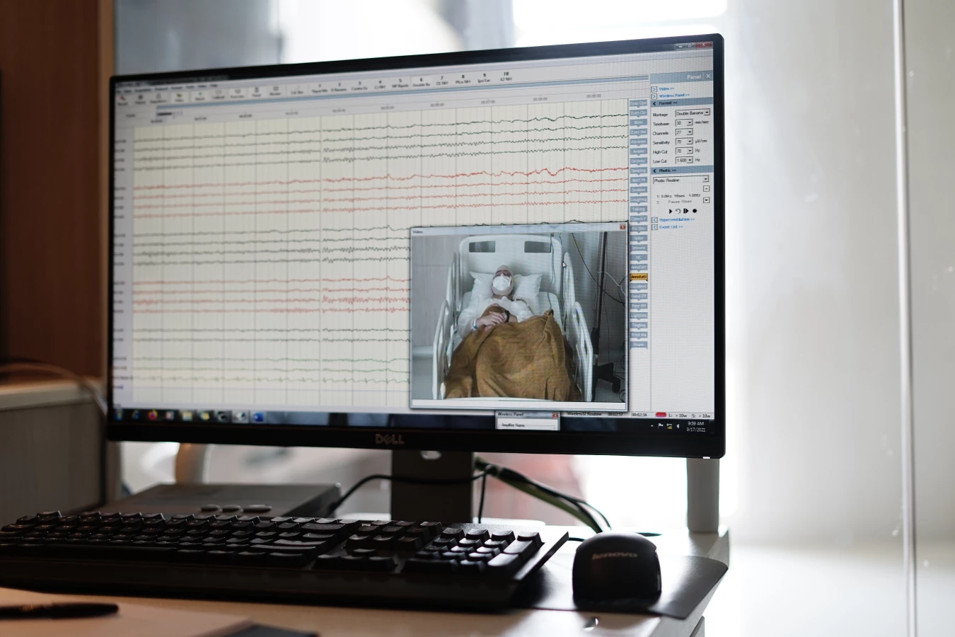 Elektroensefalografi (EEG)
