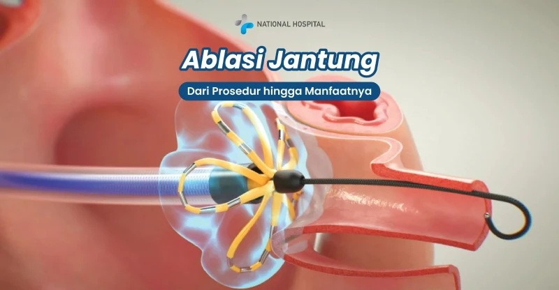 Ablasi Jantung